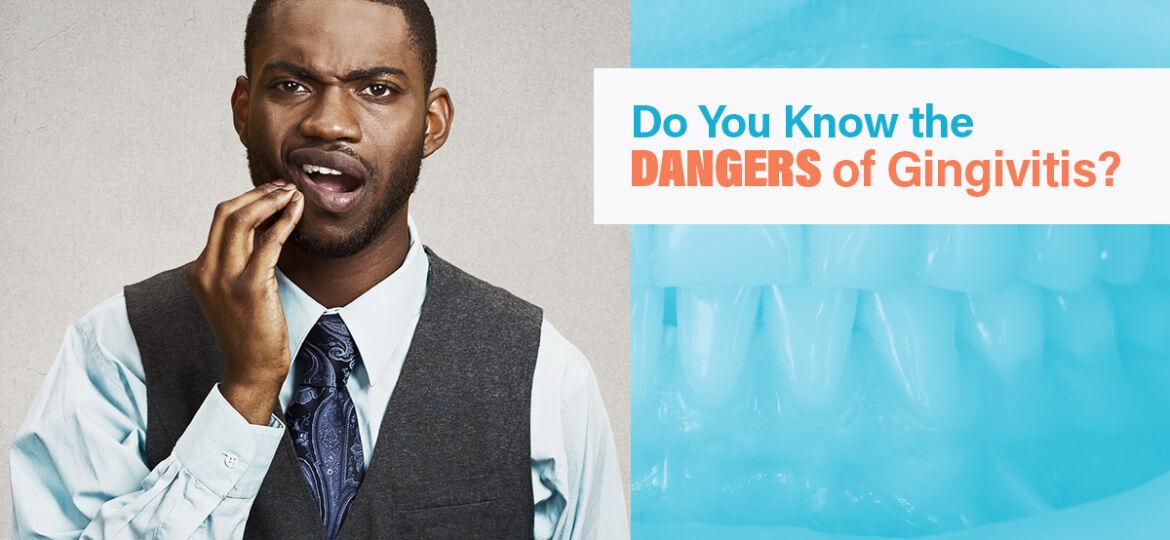 Great-Blog-Featured-IMG-Gengivitis-5902694083d77